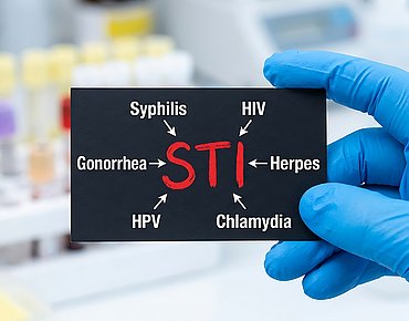STI - Sexuell übertragbare Krankheiten STI - Sexuell übertragbare Krankheiten