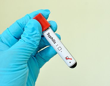 Positiver Test Syphillis