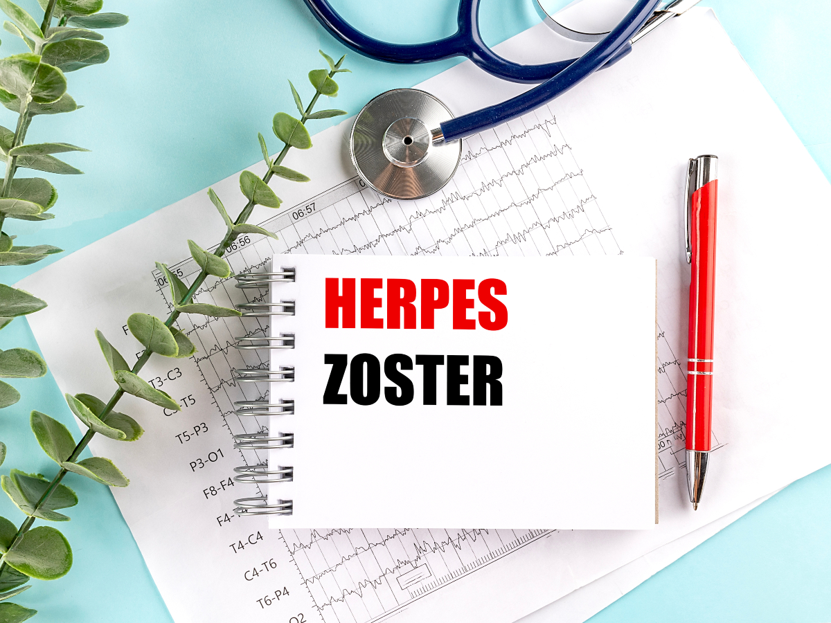 Herpes zoster
